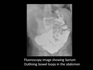 Abdominal fluoroscopy