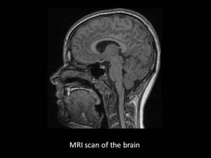 Brain MRI scan