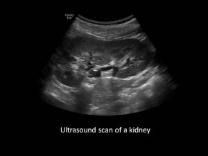 Kidney Ultrasound