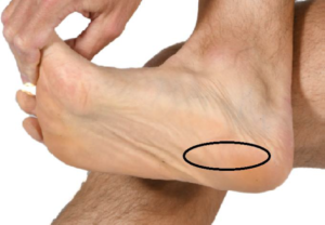 Image of a foot being held by the big toe with the heel part of the foot circled in black