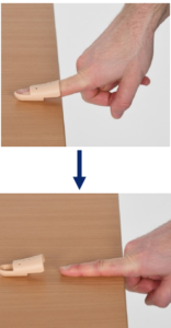 Two photographs showing the steps of removing a finger splint. In the top image, a hand with a finger splint rests on a table edge. In the bottom image, the splint has been removed, and the finger is fully extended and flat on the table surface, demonstrating the correct technique for removing the splint without bending the injured finger.